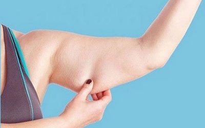 لیپوماتیک بازو برای لاغر و سفت کردن